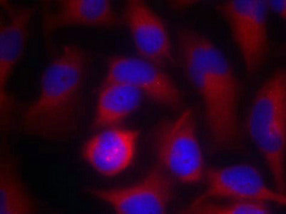 Immunofluorescence staining of methanol-fixed Hela cells using PAK1(Ab-212) Antibody.Rabbit anti-Human PAK1 Polyclonal Antibody