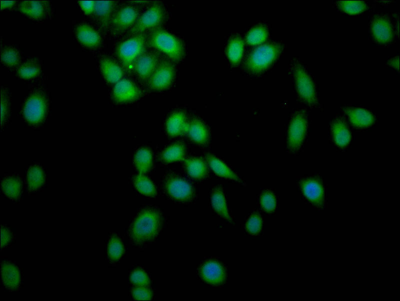 Immunofluorescence staining of Hela cells with ZKSCAN3 Antibody at 1:200, counter-stained with DAPI.The cells were fixed in 4% formaldehyde, permeated by 0.2% TritonX-100, and blocked in 10% normal Goat Serum. The cells were then incubated with the antibody overnight at 4°C. Nuclear DNA was labeled in blue with DAPI. The secondary antibody was Alexa Fluor 488-congugated AffiniPure Goat Anti-Rabbit IgG(H+L)Rabbit anti-Human ZKSCAN3 Polyclonal Antibody