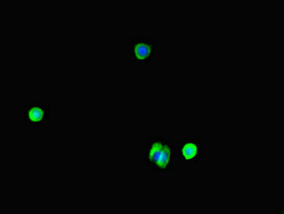 Immunofluorescent analysis of MCF-7 cells using WAC Antibody at dilution of 1:100 and Alexa Fluor 488-congugated AffiniPure Goat Anti-Rabbit IgG(H+L)