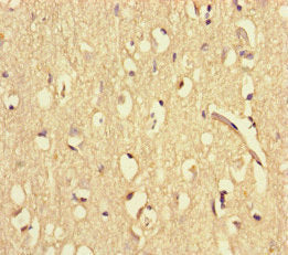 Immunohistochemistry of paraffin-embedded human brain tissue using the antibody at dilution of 1:100