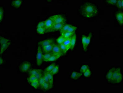 Immunofluorescence staining of HepG2 cells with SLC26A6 Antibody at 1:133, counter-stained with DAPI. The cells were fixed in 4% formaldehyde, permeabilized using 0.2% Triton X-100 and blocked in 10% normal Goat Serum. The cells were then incubated with the antibody overnight at 4°C. The secondary antibody was Alexa Fluor 488-congugated AffiniPure Goat Anti-Rabbit IgG(H+L).Rabbit anti-Human SLC26A6 Polyclonal Antibody
