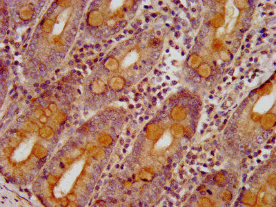 IHC image of the antibody diluted at 1:400 and staining in paraffin-embedded human small intestine tissue performed on a Leica BondTM system. After dewaxing and hydration, antigen retrieval was mediated by high pressure in a citrate buffer (pH 6.0). Section was blocked with 10% normal goat serum 30min at RT. Then primary antibody (1% BSA) was incubated at 4°C overnight. The primary is detected by a biotinylated secondary antibody and visualized using an HRP conjugated SP system.Rabbit anti-Human SLC26A6 Polyclonal Antibody