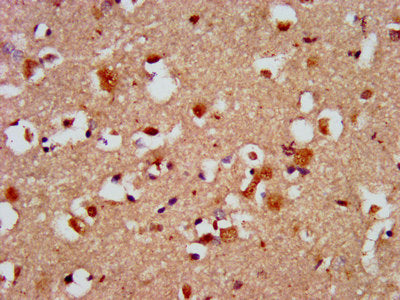 IHC image of CAPS2 Antibody diluted at 1:500 and staining in paraffin-embedded human brain tissue performed on a Leica BondTM system. After dewaxing and hydration, antigen retrieval was mediated by high pressure in a citrate buffer (pH 6.0). Section was blocked with 10% normal goat serum 30min at RT. Then primary antibody (1% BSA) was incubated at 4°C overnight. The primary is detected by a biotinylated secondary antibody and visualized using an HRP conjugated SP system.