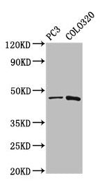 Western Blot  | Positive WB detected in: PC-3 whole cell lysate, Colo320 whole cell lysate  | All lanes: CAPS2 antibody at 5.2µg/ml  | Secondary  | Goat polyclonal to rabbit IgG at 1/50000 dilution  | Predicted band size: 64, 45, 34 kDa  | Observed band size: 45 kDa