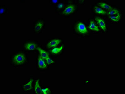 Immunofluorescence staining of HepG2 cells with PARD6B Antibody at 1:108, counter-stained with DAPI. The cells were fixed in 4% formaldehyde, permeabilized using 0.2% Triton X-100 and blocked in 10% normal Goat Serum. The cells were then incubated with the antibody overnight at 4°C. The secondary antibody was Alexa Fluor 488-congugated AffiniPure Goat Anti-Rabbit IgG(H+L).Rabbit anti-Human PARD6B Polyclonal Antibody