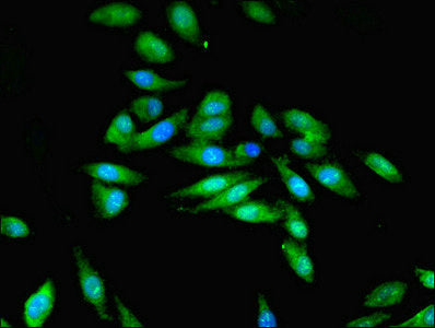 Immunofluorescent analysis of Hela cells using STK33 Antibody at dilution of 1:100 and Alexa Fluor 488-congugated AffiniPure Goat Anti-Rabbit IgG(H+L)Rabbit anti-Human STK33 Polyclonal Antibody