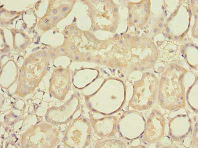 Immunohistochemistry of paraffin-embedded human kidney tissue using STK33 Antibody at dilution of 1:100Rabbit anti-Human STK33 Polyclonal Antibody