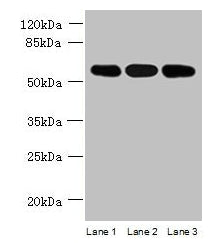 Western blot  | All lanes: STK33 antibody at 4µg/ml  | Lane 1: Mouse kidney tissue  | Lane 2: Hela whole cell lysate  | Lane 3: Jurkat whole cell lysate  | Secondary  | Goat polyclonal to rabbit IgG at 1/10000 dilution  | Predicted band size: 58, 51 kDa  | Observed band size: 58 kDaRabbit anti-Human STK33 Polyclonal Antibody