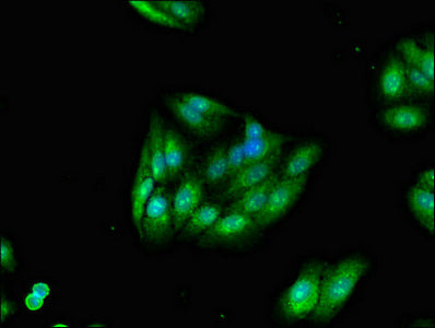 Immunofluorescent analysis of HepG2 cells using TRIM54 Antibody at dilution of 1:100 and Alexa Fluor 488-congugated AffiniPure Goat Anti-Rabbit IgG(H+L)Rabbit anti-Human TRIM54 Polyclonal Antibody
