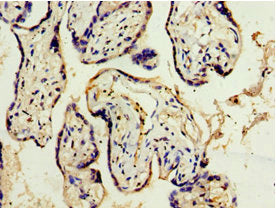 Immunohistochemistry of paraffin-embedded human placenta tissue using ADAM33 Antibody at dilution of 1:100Rabbit anti-Human ADAM33 Polyclonal Antibody