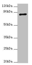 Western blot | All lanes: ADAM33 antibody at 4μg/ml + NIH/3T3 whole cell lysate | Secondary | Goat polyclonal to rabbit IgG at 1/10000 dilution | Predicted band size: 88, 85, 33 kDa | Observed band size: 88 kDa
