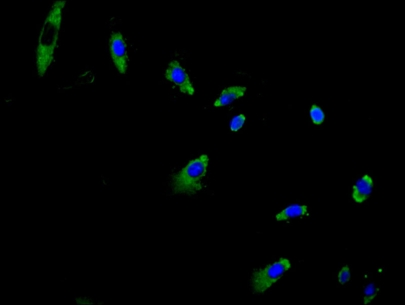 Immunofluorescent analysis of 293T cells using ZDHHC5 Antibody at dilution of 1:100 and Alexa Fluor 488-congugated AffiniPure Goat Anti-Rabbit IgG(H+L)Rabbit anti-Human ZDHHC5 Polyclonal Antibody