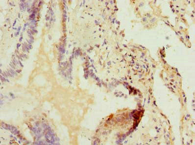 Immunohistochemistry of paraffin-embedded human lung tissue using ZDHHC5 Antibody at dilution of 1:100Rabbit anti-Human ZDHHC5 Polyclonal Antibody