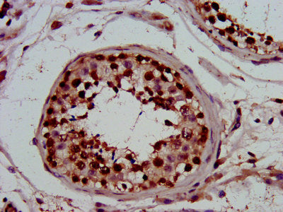 IHC image of PIN4 Antibody diluted at 1:800 and staining in paraffin-embedded human testis tissue performed on a Leica BondTM system. After dewaxing and hydration, antigen retrieval was mediated by high pressure in a citrate buffer (pH 6.0). Section was blocked with 10% normal goat serum 30min at RT. Then primary antibody (1% BSA) was incubated at 4°C overnight. The primary is detected by a biotinylated secondary antibody and visualized using an HRP conjugated SP system.Rabbit anti-Human PIN4 Polyclonal Antibody