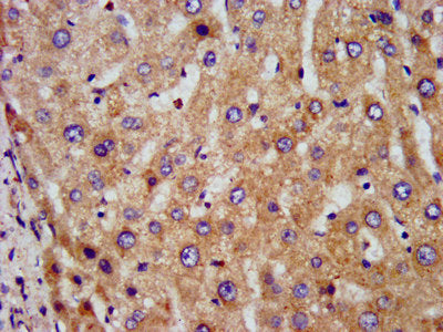 IHC image of DLST Antibody diluted at 1:300 and staining in paraffin-embedded human liver tissue performed on a Leica BondTM system. After dewaxing and hydration, antigen retrieval was mediated by high pressure in a citrate buffer (pH 6.0). Section was blocked with 10% normal goat serum 30min at RT. Then primary antibody (1% BSA) was incubated at 4°C overnight. The primary is detected by a biotinylated secondary antibody and visualized using an HRP conjugated SP system.Rabbit anti-Human DLST Polyclonal Antibody