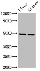 Western Blot | Positive WB detected in: Rat liver tissue, Rat kidney tissue | All lanes: DLST antibody at 5.9μg/ml | Secondary | Goat polyclonal to rabbit IgG at 1/50000 dilution | Predicted band size: 49, 40 kDa | Observed band size: 49 kDaRabbit anti-Human DLST Polyclonal Antibody