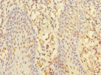 Immunohistochemistry of paraffin-embedded human tonsil tissue using CHRNA10 Antibody at dilution of 1:100Rabbit anti-Human CHRNA10 Polyclonal Antibody