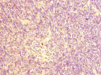 Immunohistochemistry of paraffin-embedded human thymus tissue using CHRNA10 Antibody at dilution of 1:100Rabbit anti-Human CHRNA10 Polyclonal Antibody