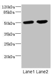 Western blot  | All lanes: CHRNA10 antibody at 0.57µg/ml  | Lane 1: Jurkat whole cell lysate  | Lane 2: A549 whole cell lysate  | Secondary  | Goat polyclonal to rabbit IgG at 1/10000 dilution  | Predicted band size: 50 kDa  | Observed band size: 50 kDaRabbit anti-Human CHRNA10 Polyclonal Antibody