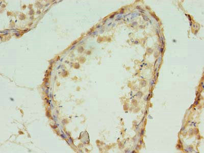 Immunohistochemistry of paraffin-embedded human testis tissue using MRPL18 Antibody at dilution of 1:100Rabbit anti-Human MRPL18 Polyclonal Antibody