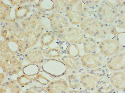 Immunohistochemistry of paraffin-embedded human kidney tissue using MRPL18 Antibody at dilution of 1:100Rabbit anti-Human MRPL18 Polyclonal Antibody