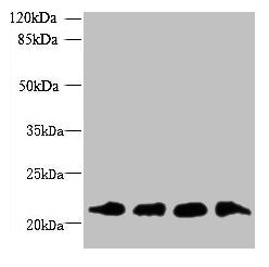 Western blot  | All lanes: MRPL18 antibody at 8µg/ml  | Lane 1: U251 whole cell lysate  | Lane 2: THP-1 whole cell lysate  | Lane 3: PC-3 whole cell lysate  | Lane 4: U87 whole cell lysate  | Secondary  | Goat polyclonal to rabbit IgG at 1/10000 dilution  | Predicted band size: 21 kDa  | Observed band size: 21 kDaRabbit anti-Human MRPL18 Polyclonal Antibody