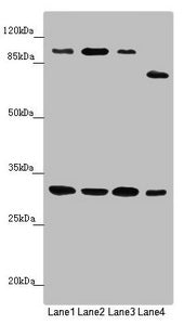 Western blot | All lanes: MTIF3 antibody at 1.15 μg/ml | Lane 1: Mouse small intestine tissue | Lane 2: Rat heart tissue | Lane 3: Mouse liver tissue | Lane 4: Hela whole cell lysate | Secondary | Goat polyclonal to rabbit IgG at 1/10000 dilution | Predicted band size: 32 kDa | Observed band size: 32, 100, 75 kDaRabbit anti-Human MTIF3 Polyclonal Antibody