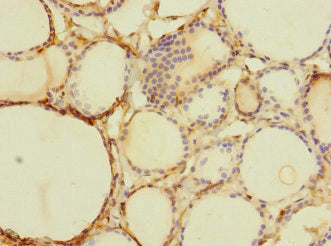 Immunohistochemistry of paraffin-embedded human thyroid tissue using TTC12 Antibody at dilution of 1:100Rabbit anti-Human TTC12 Polyclonal Antibody