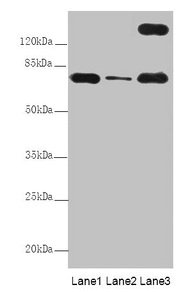 Western Blot  | All lanes: TTC12 antibody at 8µg/ml  | Lane 1: Mouse large intestine tissue  | Lane 2: Mouse small intestine tissue  | Lane 3: HepG2 whole cell lysate  | Secondary  | Goat polyclonal to rabbit IgG at 1/10000 dilution  | Predicted band size: 79, 82 kDa  | Observed band size: 79, 170 kDaRabbit anti-Human TTC12 Polyclonal Antibody