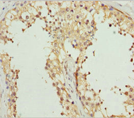 Immunohistochemistry of paraffin-embedded human?testis tissue using REEP1 Antibody at dilution of 1:100Rabbit anti-Human REEP1 Polyclonal Antibody
