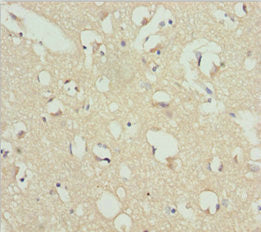 Immunohistochemistry of paraffin-embedded human brain tissue using REEP1 Antibody at dilution of 1:100Rabbit anti-Human REEP1 Polyclonal Antibody