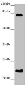Western blot | All lanes: REEP1 antibody at 5.84 μg/ml + Mouse gonadal tissue | Secondary | Goat polyclonal to rabbit IgG at 1/10000 dilution | Predicted band size: 23, 19, 17 kDa | Observed band size: 23, 80 kDaRabbit anti-Human REEP1 Polyclonal Antibody