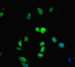 Immunofluorescent analysis of Hela cells using MED20 Antibody at dilution of 1:100 and Alexa Fluor 488-congugated AffiniPure Goat Anti-Rabbit IgG(H+L)