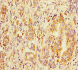 Immunohistochemistry of paraffin-embedded human pancreatic tissue using MED20 Antibody at dilution of 1:100