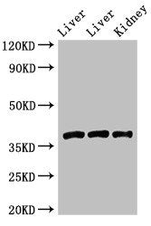 Western Blot | Positive WB detected in: Rat liver tissue, Mouse liver tissue, Mouse kidney tissue | All lanes: GNB4 antibody at 2μg/ml | Secondary | Goat polyclonal to rabbit IgG at 1/50000 dilution | Predicted band size: 38 kDa | Observed band size: 38 kDaRabbit anti-Human GNB4 Polyclonal Antibody