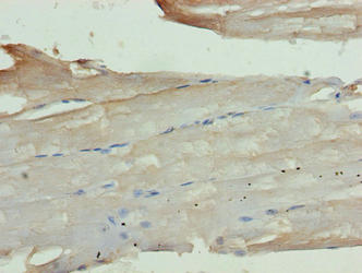 Immunohistochemistry of paraffin-embedded human skeletal muscle tissue using KCNK13 Antibody at dilution of 1:100