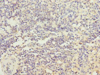 Immunohistochemistry of paraffin-embedded human spleen tissue using IL21R Antibody at dilution of 1:100Rabbit anti-Human IL21R Polyclonal Antibody