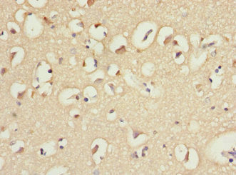 Immunohistochemistry of paraffin-embedded human brain tissue using IL21R Antibody at dilution of 1:100Rabbit anti-Human IL21R Polyclonal Antibody