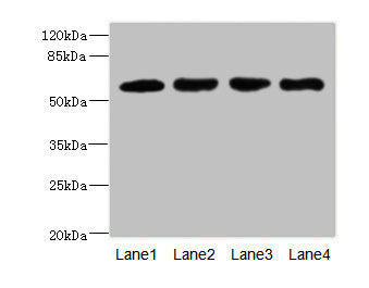 Western blot | All lanes: IL21R antibody at 2.18μg/ml | Lane 1: A549 whole cell lysate | Lane 2: Raji whole cell lysate | Lane 3: Colo320 whole cell lysate | Lane 4: K562 whole cell lysate | Secondary | Goat polyclonal to rabbit IgG at 1/10000 dilution | Predicted band size: 59 kDa | Observed band size: 59 kDaRabbit anti-Human IL21R Polyclonal Antibody
