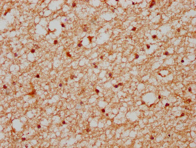 IHC image of XAB2 Antibody diluted at 1:400 and staining in paraffin-embedded human brain tissue performed on a Leica BondTM system. After dewaxing and hydration, antigen retrieval was mediated by high pressure in a citrate buffer (pH 6.0). Section was blocked with 10% normal goat serum 30min at RT. Then primary antibody (1% BSA) was incubated at 4°C overnight. The primary is detected by a biotinylated secondary antibody and visualized using an HRP conjugated SP system.