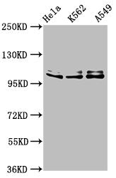 Western Blot  | Positive WB detected in: Hela whole cell lysate, K562 whole cell lysate, A549 whole cell lysate  | All lanes: XAB2 antibody at 3μg/ml  | Secondary  | Goat polyclonal to rabbit IgG at 1/50000 dilution  | Predicted band size: 101 kDa  | Observed band size: 101 kDa