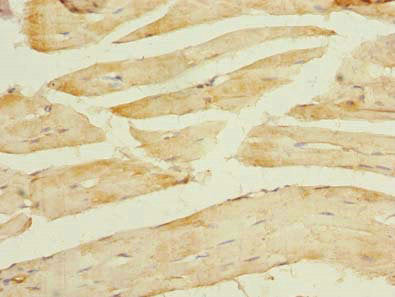 Immunohistochemistry of paraffin-embedded human skeletal muscle tissue using TCEAL7 Antibody at dilution of 1:100Rabbit anti-Human TCEAL7 Polyclonal Antibody