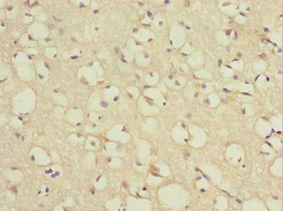 Immunohistochemistry of paraffin-embedded human brain tissue using TCEAL7 Antibody at dilution of 1:100Rabbit anti-Human TCEAL7 Polyclonal Antibody