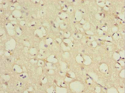 Immunohistochemistry of paraffin-embedded human brain tissue using TCEAL7 Antibody at dilution of 1:100Rabbit anti-Human TCEAL7 Polyclonal Antibody