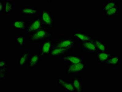Immunofluorescence staining of Hela cells with PCGF1 Antibody at 1:133, counter-stained with DAPI. The cells were fixed in 4% formaldehyde, permeabilized using 0.2% Triton X-100 and blocked in 10% normal Goat Serum. The cells were then incubated with the antibody overnight at 4°C. The secondary antibody was Alexa Fluor 488-congugated AffiniPure Goat Anti-Rabbit IgG(H+L).Rabbit anti-Human PCGF1 Polyclonal Antibody