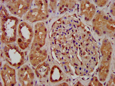 IHC image of the antibody diluted at 1:400 and staining in paraffin-embedded human kidney tissue performed on a Leica BondTM system. After dewaxing and hydration, antigen retrieval was mediated by high pressure in a citrate buffer (pH 6.0). Section was blocked with 10% normal goat serum 30min at RT. Then primary antibody (1% BSA) was incubated at 4°C overnight. The primary is detected by a biotinylated secondary antibody and visualized using an HRP conjugated SP system.Rabbit anti-Human PCGF1 Polyclonal Antibody