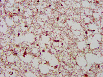IHC image of PCGF1 Antibody diluted at 1:400 and staining in paraffin-embedded human brain tissue performed on a Leica BondTM system. After dewaxing and hydration, antigen retrieval was mediated by high pressure in a citrate buffer (pH 6.0). Section was blocked with 10% normal goat serum 30min at RT. Then primary antibody (1% BSA) was incubated at 4°C overnight. The primary is detected by a biotinylated secondary antibody and visualized using an HRP conjugated SP system.Rabbit anti-Human PCGF1 Polyclonal Antibody