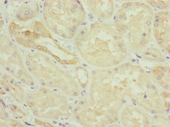 Immunohistochemistry of paraffin-embedded human kidney tissue using HAUS8 Antibody at dilution of 1:100Rabbit anti-Human HAUS8 Polyclonal Antibody
