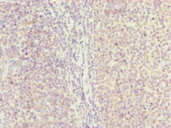 Immunohistochemistry of paraffin-embedded human tonsil tissue using HAUS8 Antibody at dilution of 1:100Rabbit anti-Human HAUS8 Polyclonal Antibody