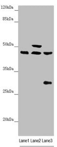 Western blot | All lanes: HAUS8 antibody at 2.35 μg/ml | Lane 1: Mouse kidney tissue | Lane 2: Mouse brain tissue | Lane 3: A549 whole cell lysate | Secondary | Goat polyclonal to rabbit IgG at 1/10000 dilution | Predicted band size: 45, 39 kDa | Observed band size: 45, 50, 28 kDaRabbit anti-Human HAUS8 Polyclonal Antibody